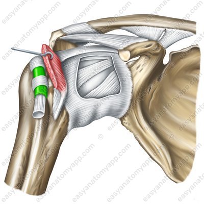 Intertubercular tendon sheath (vagina tendinis intertubercularis)